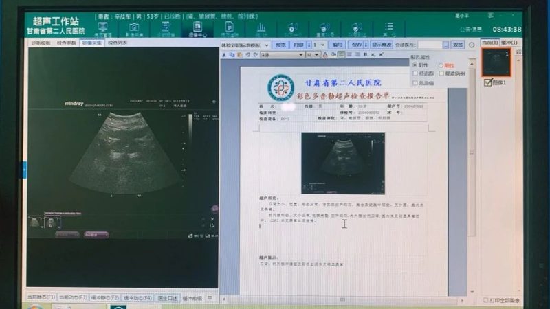 体检中心体检流程揭秘：了解流程，合理选择